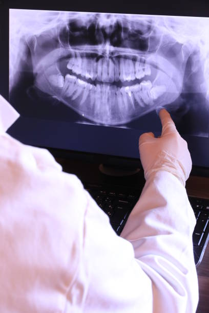 Best Emergency Root Canal Treatment in Castle Rock, CO