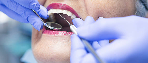 Best Emergency Dental Extractions in Castle Rock, CO